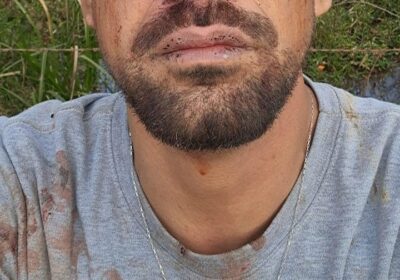 Motorista de aplicativo se recupera após ser rendido em assalto no Cidade Nova